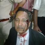 Mohammad Saleem, Khalid Mujahid’s lawyer attacked and injured by Hindutwa lawyers