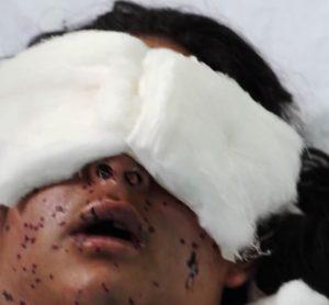 kashmir-casualties